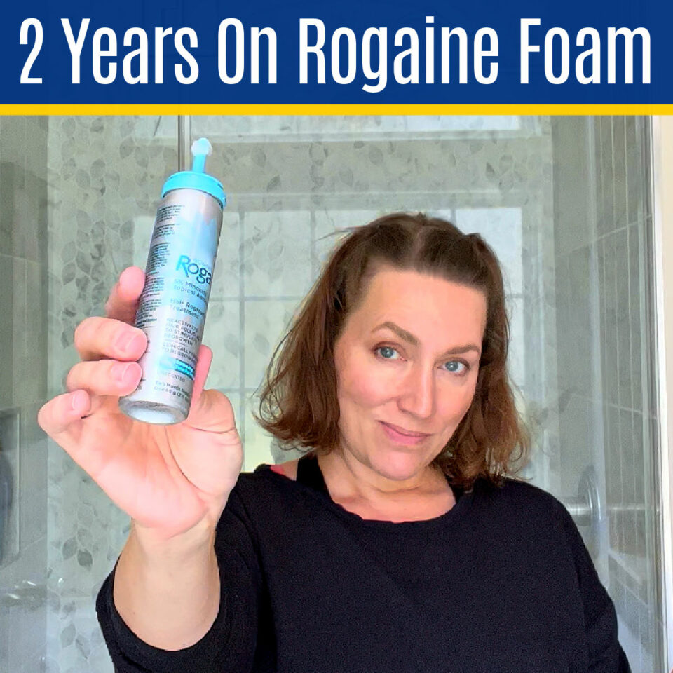 Helpful Tips: 2 Year Minoxidil Hair Growth Results Using Rogaine Foam ...